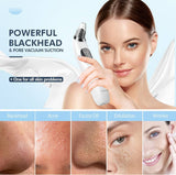 Facial Pore Vacuum Blackhead & Skin-Care Cleansing Tool