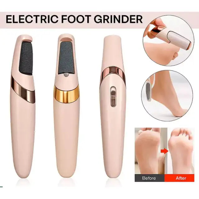 Electric Foot Callus Remover Pedicure Kit – Gentle Daily Care