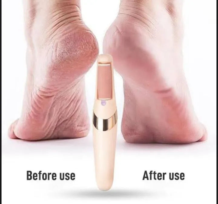 Electric Foot Callus Remover Pedicure Kit – Gentle Daily Care