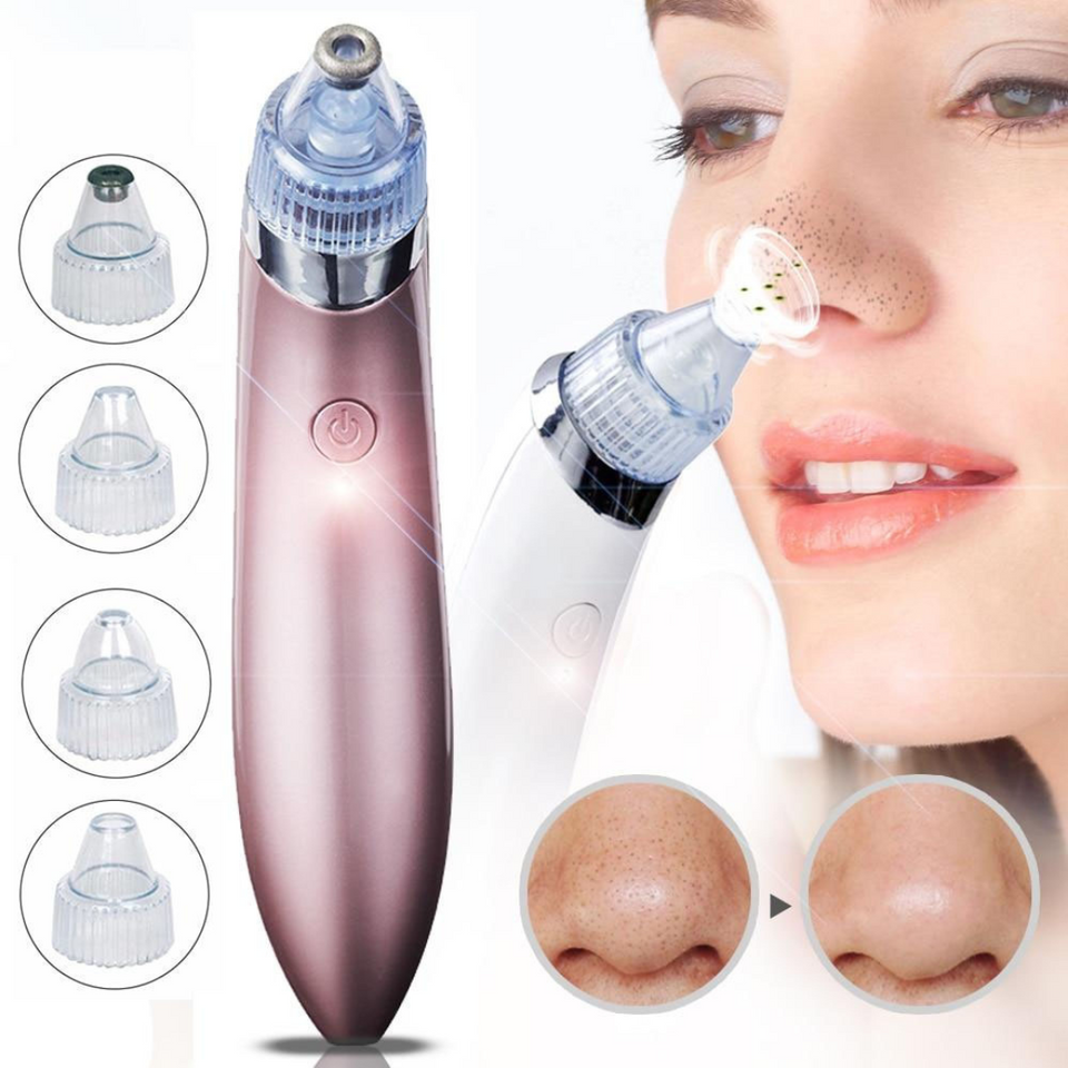 Facial Pore Vacuum Blackhead & Skin-Care Cleansing Tool