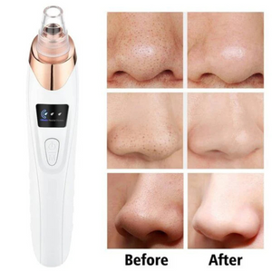 Facial Pore Vacuum Blackhead & Skin-Care Cleansing Tool