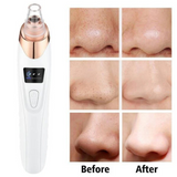 Facial Pore Vacuum Blackhead & Skin-Care Cleansing Tool