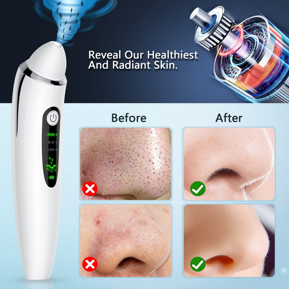 Facial Pore Vacuum Blackhead & Skin-Care Cleansing Tool