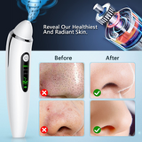 Facial Pore Vacuum Blackhead & Skin-Care Cleansing Tool