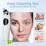 Facial Pore Vacuum Blackhead & Skin-Care Cleansing Tool