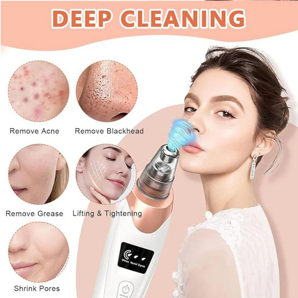 Facial Pore Vacuum Blackhead & Skin-Care Cleansing Tool