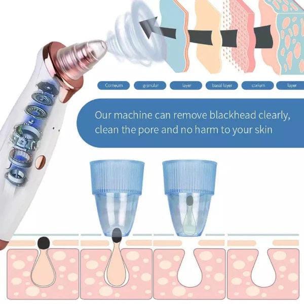 Black Head Remover Machine 5 In 1 – Gentle Daily Care