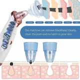 Black Head Remover Machine 5 In 1 – Gentle Daily Care