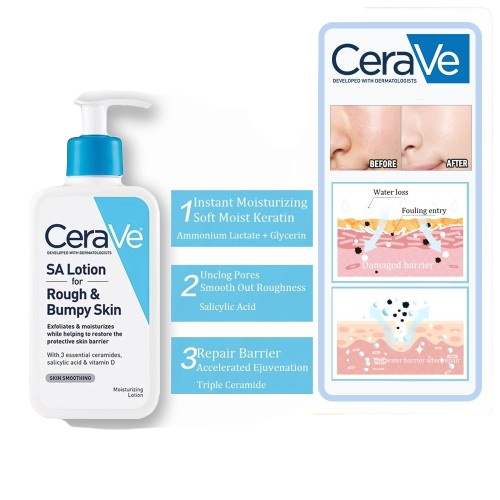 CeraVe SA Lotion Rough & Bumpy Skin Care, 237ml – Gentle Daily Care
